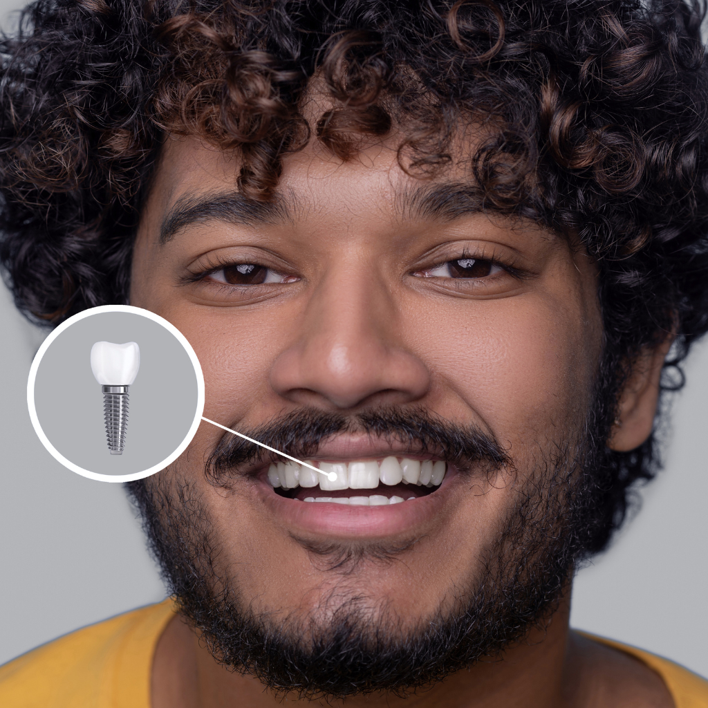 smile corrections in daffodils dentistry